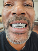 Silver Moissanite Double Bar Grillz DQ1052