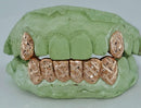 Diamond Dust - Diamond Cut Gold Grillz - DQ1012