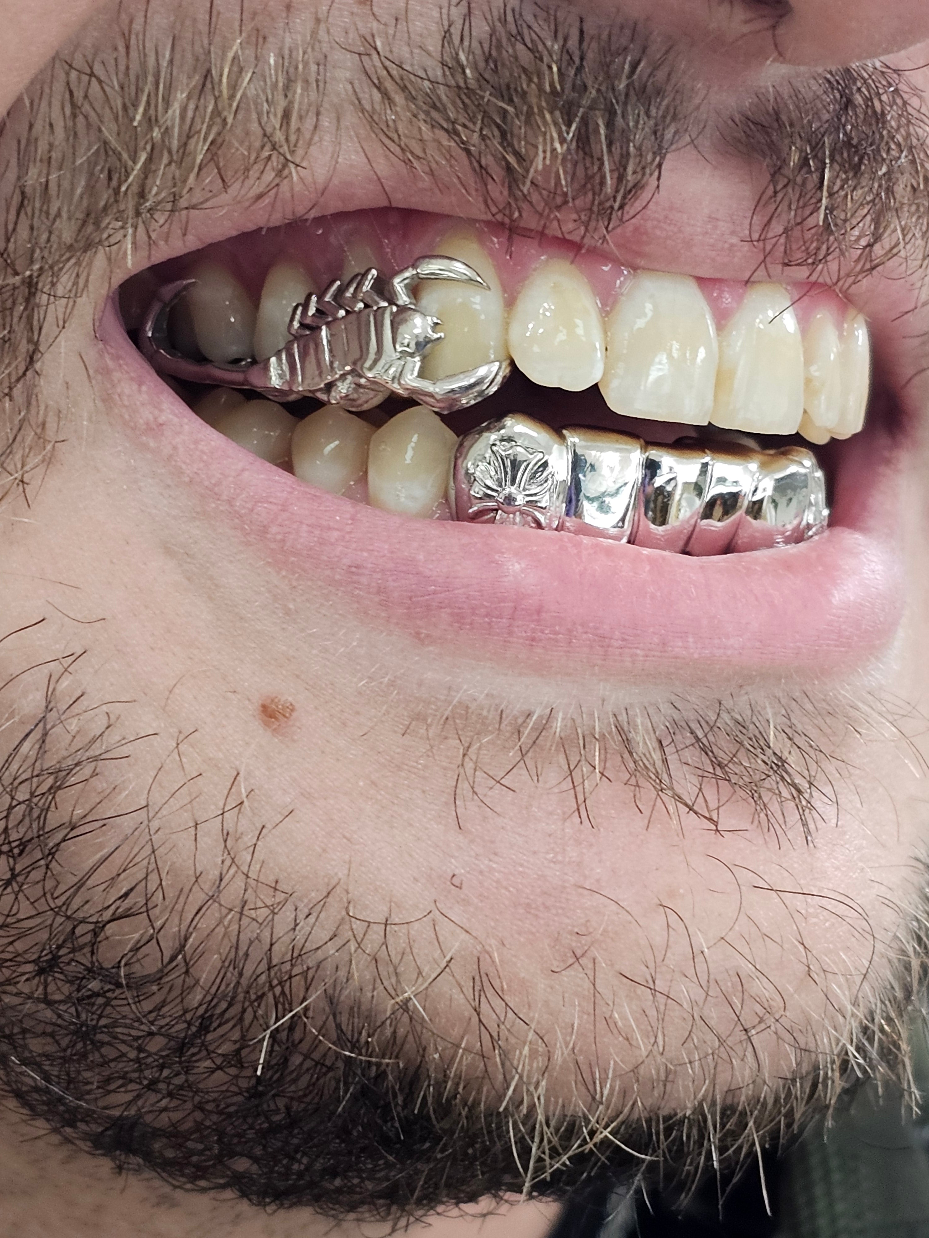 Big Ass Scorpion Grillz — Built to Sting.