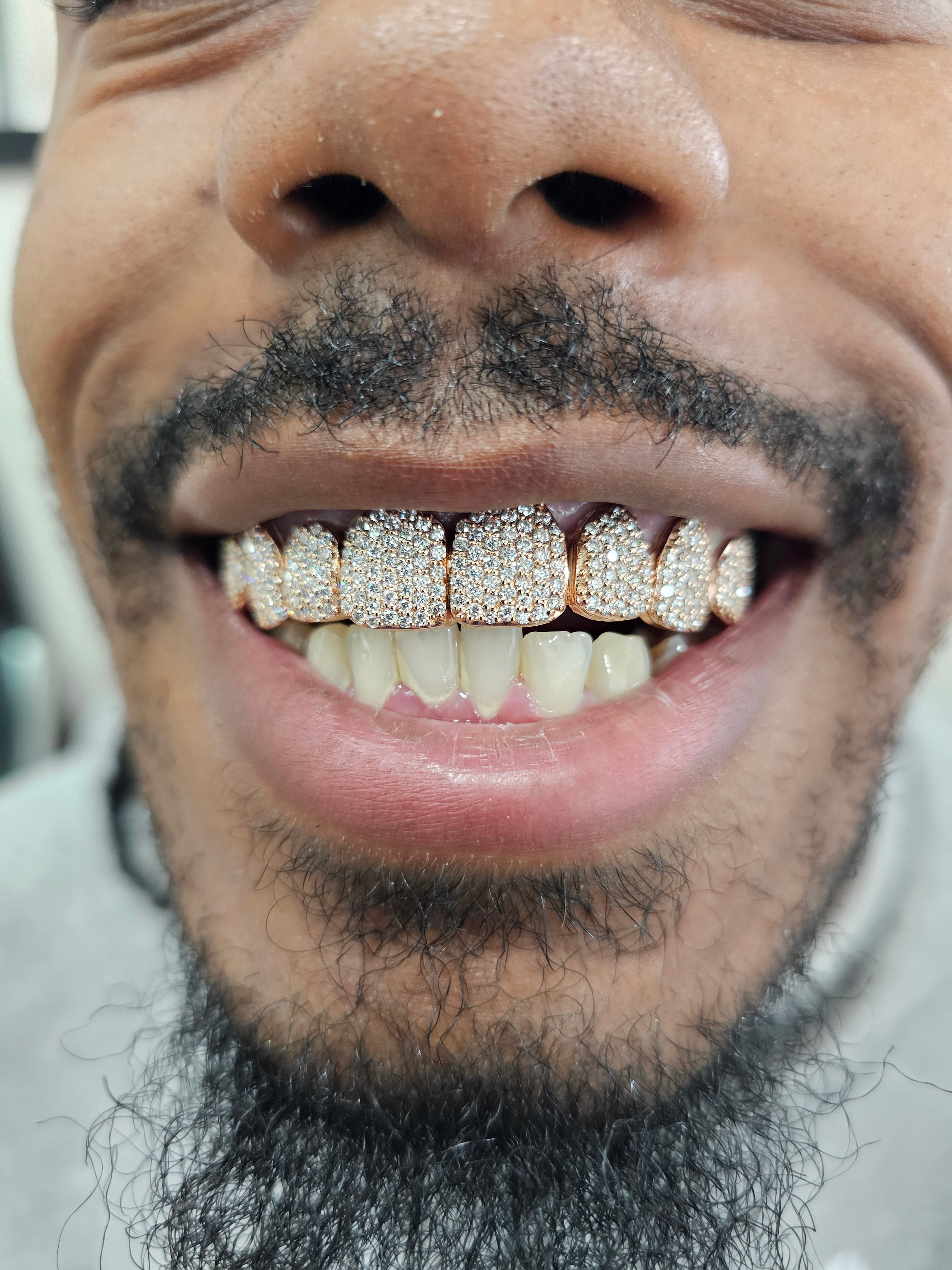 Permanent Gold Crown, Solid or Iced Out DQ1023