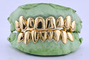 Dental Gold Grillz - NPG or 8K Gold Grillz