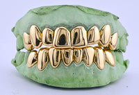 Dental Gold Grillz - NPG or 8K Gold Grillz