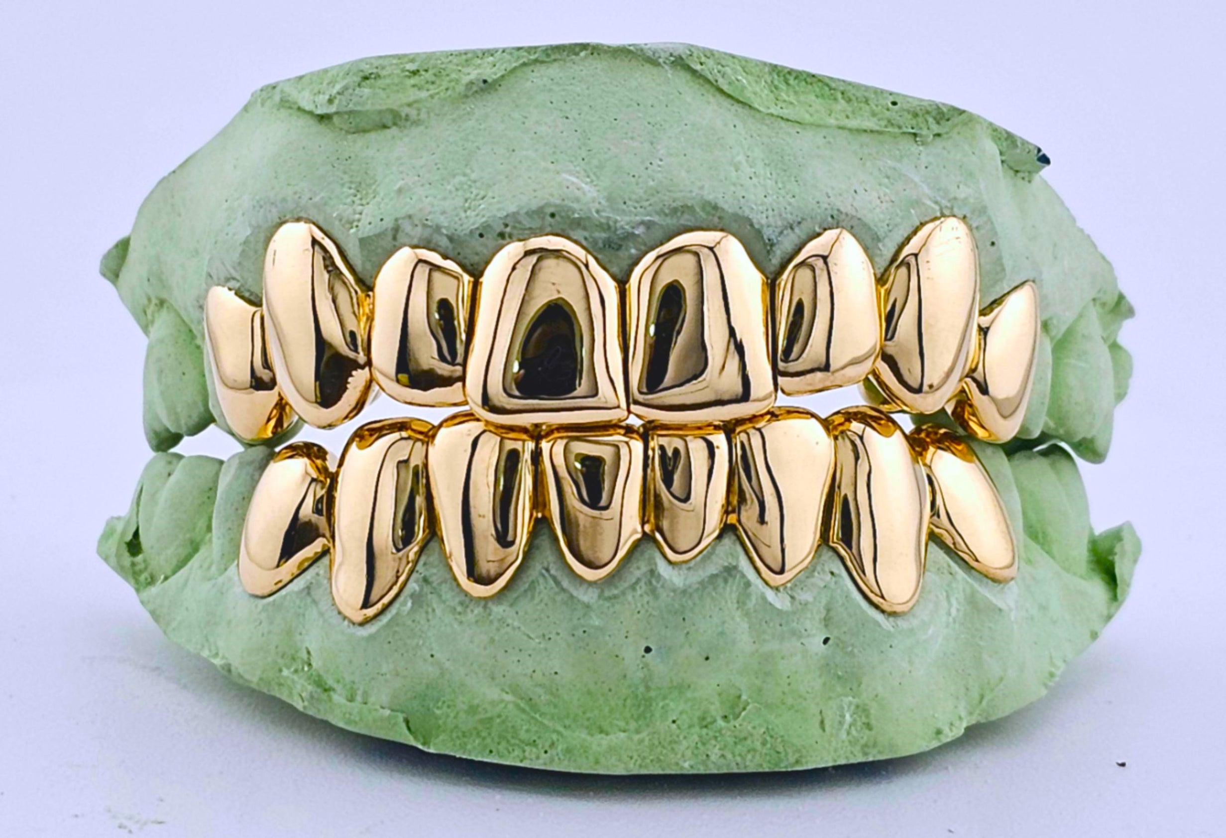Dental Gold Grillz - NPG or 8K Gold Grillz