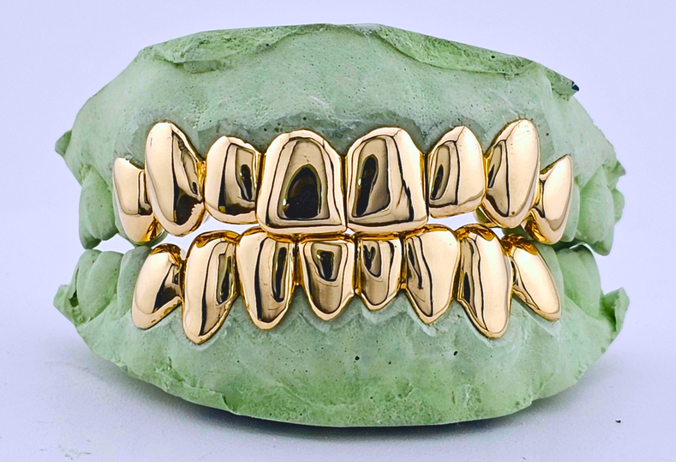 Dental Gold Grillz - NPG or 8K Gold Grillz