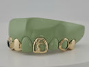 Flawless Queen Custom Gold Grillz