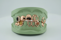 Flawless Queen Custom Gold Grillz