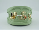 Flawless Queen Custom Gold Grillz