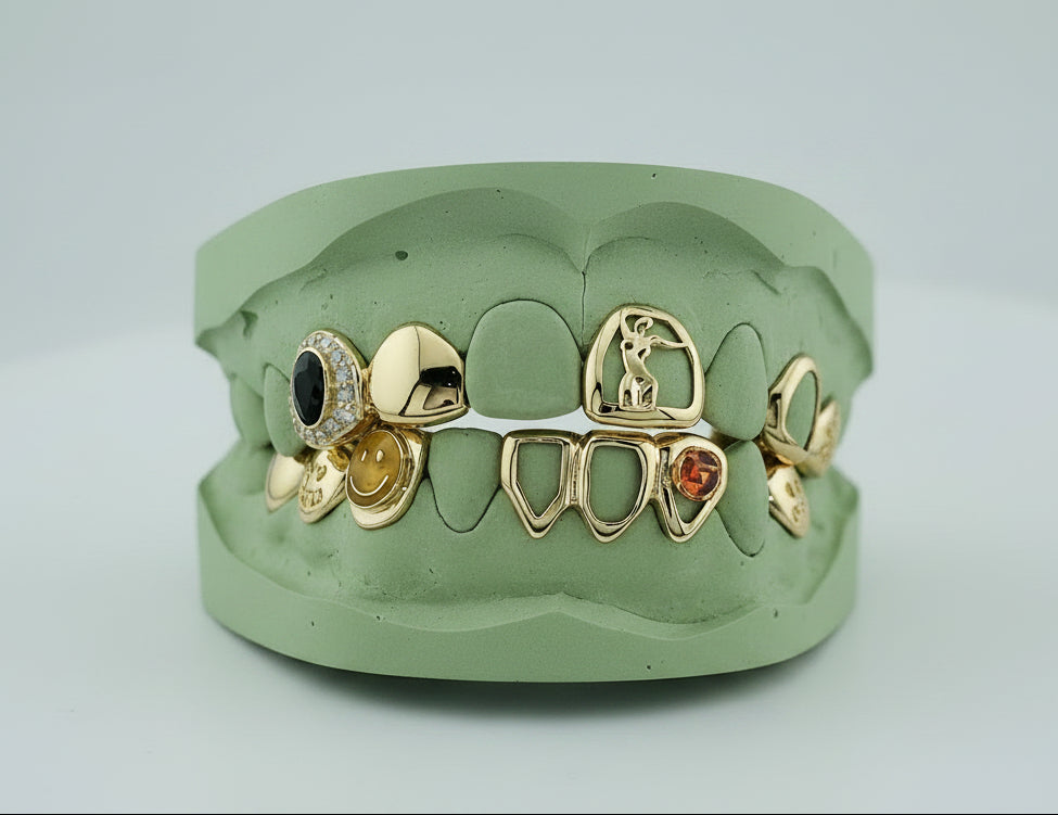 Flawless Queen Custom Gold Grillz