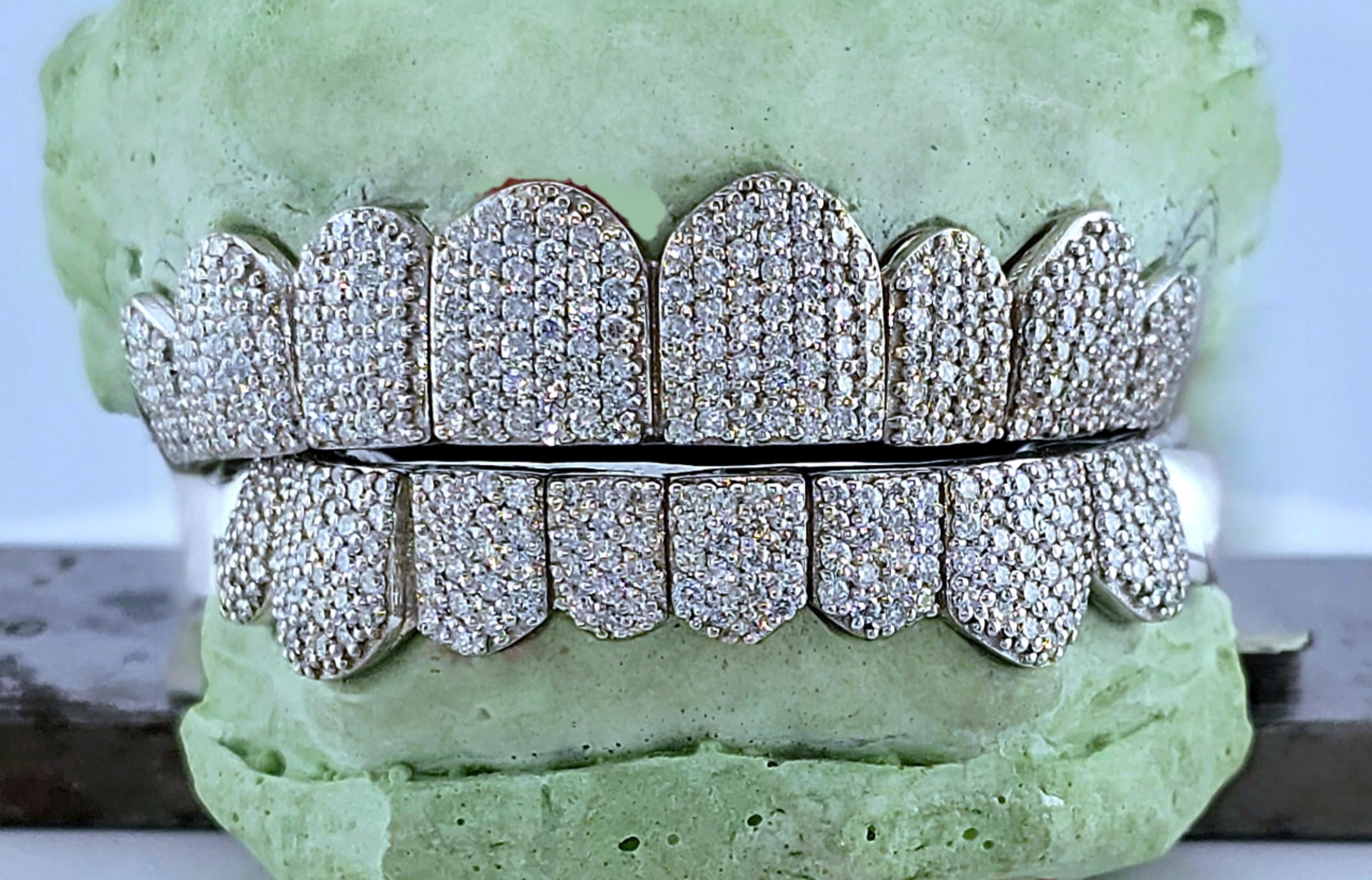 10k VVs Lab Grown Diamonds Iced Out Grillz - DQ1004