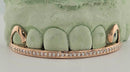 Alexis Edition Moissanite Gold Grillz – Drip & Rail Combo Now Available! DQ1059