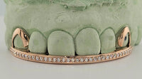 Alexis Edition Moissanite Gold Grillz – Drip & Rail Combo Now Available! DQ1059