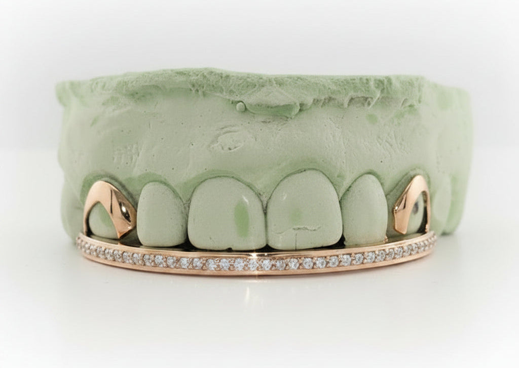 Diamond Rail Gold Grillz 6pc - DQ1020Rail