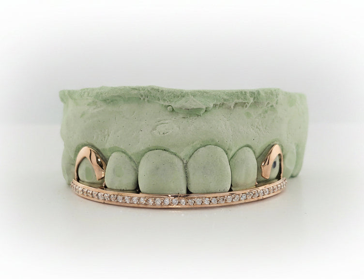 Diamond Rail Gold Grillz 6pc - DQ1020Rail