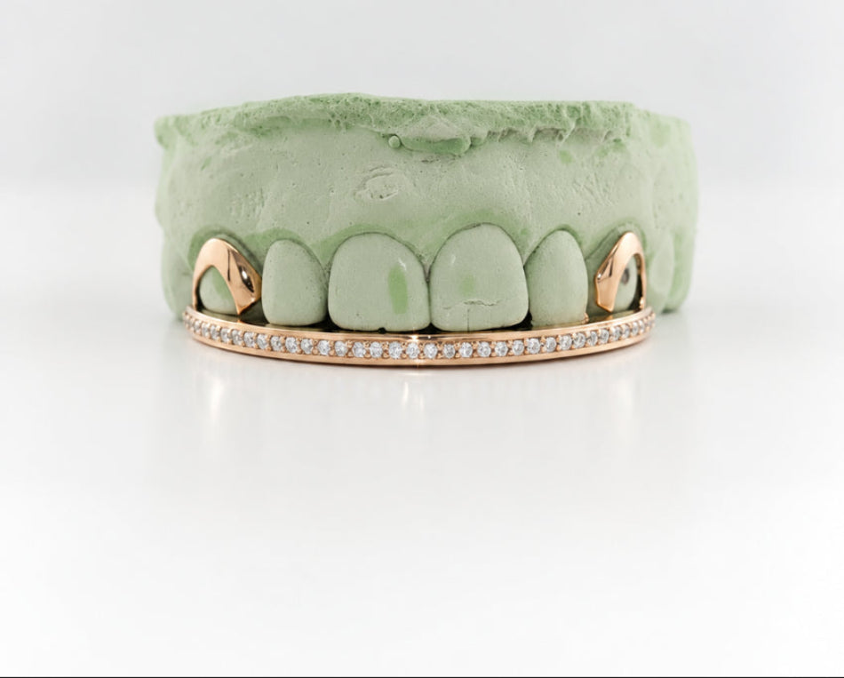 Diamond Rail Gold Grillz 6pc - DQ1020Rail