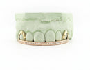 Top Bar, Diamond-Studded - DQ1007