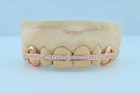 Diamond Rail Gold Grillz 6pc - DQ1020Rail