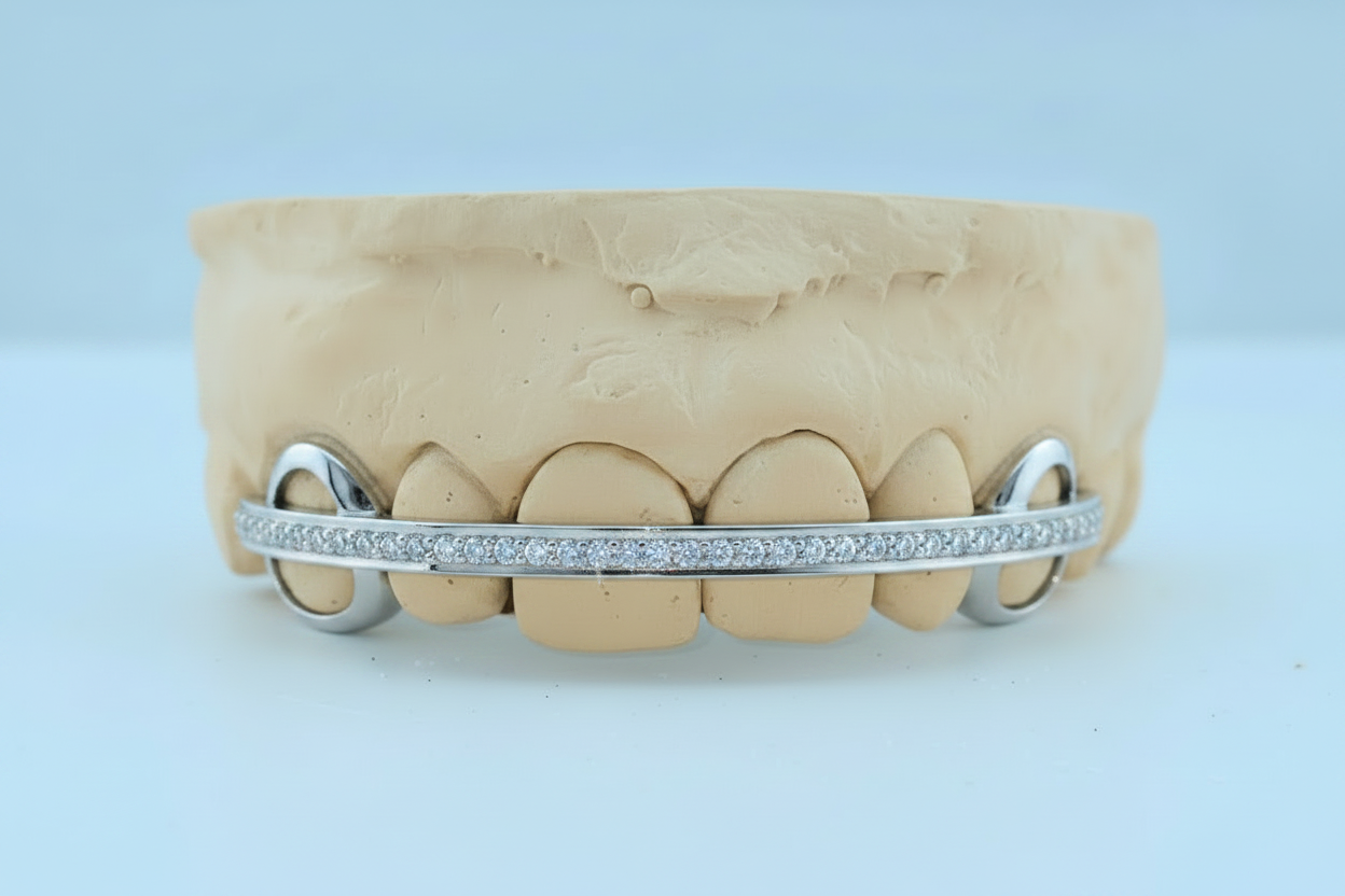 Diamond Rail Gold Grillz 6pc - DQ1020Rail