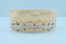 Diamond Rail Gold Grillz 6pc - DQ1020Rail