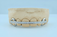 Diamond Rail Gold Grillz 6pc - DQ1020Rail
