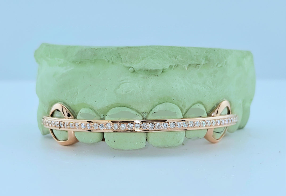 Diamond Rail Gold Grillz 6pc - DQ1020Rail