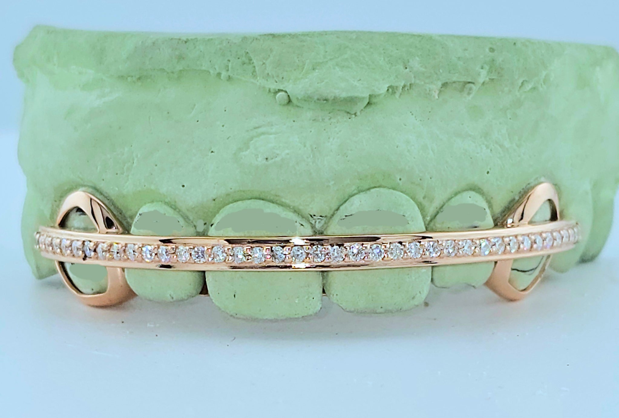 SI 다이아몬드 로우 골드 그릴즈 6개