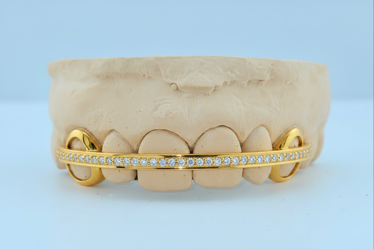 Diamond Rail Gold Grillz 6pc - DQ1020Rail