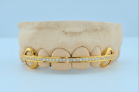 Diamond Rail Gold Grillz 6pc - DQ1020Rail