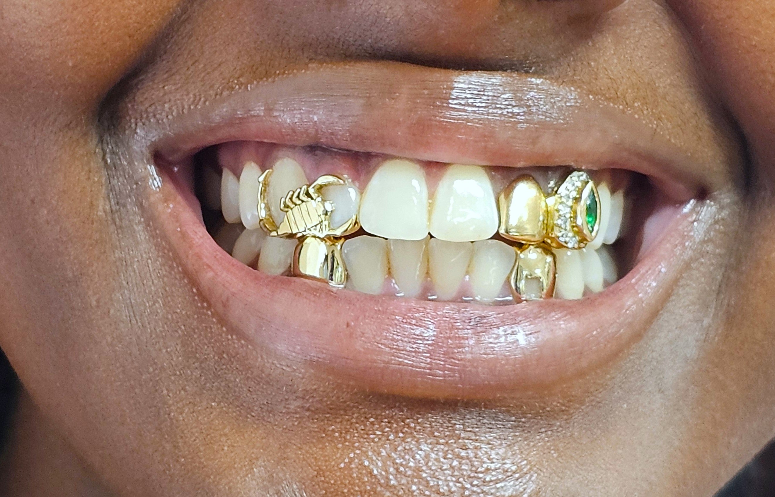 Scorpion (scorpio) Grillz Sitting On 2 Teeth