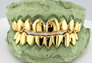 Dental Gold Grillz - NPG or 8K Gold Grillz