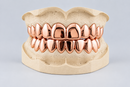 Dental Gold Grillz - NPG or 8K Gold Grillz