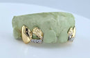 Custom Open-Face with Diamond Slugs Grillz DQ1024