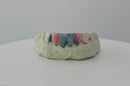 Pop-On Veneers