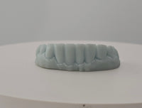 Pop-On Veneers
