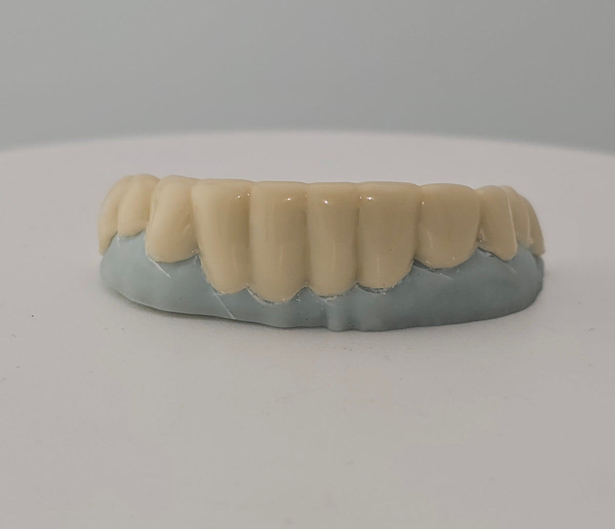 Pop-On Veneers