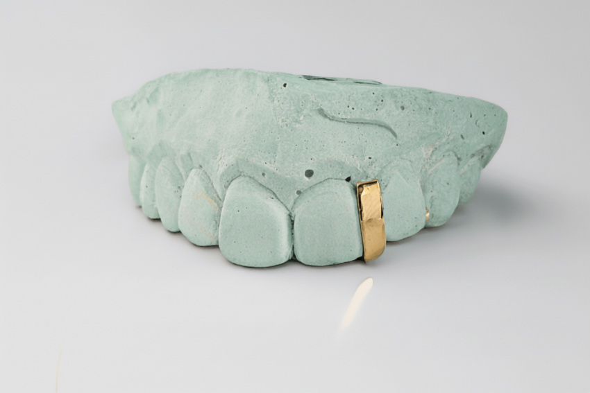 Gap Filler - Gold Teeth America