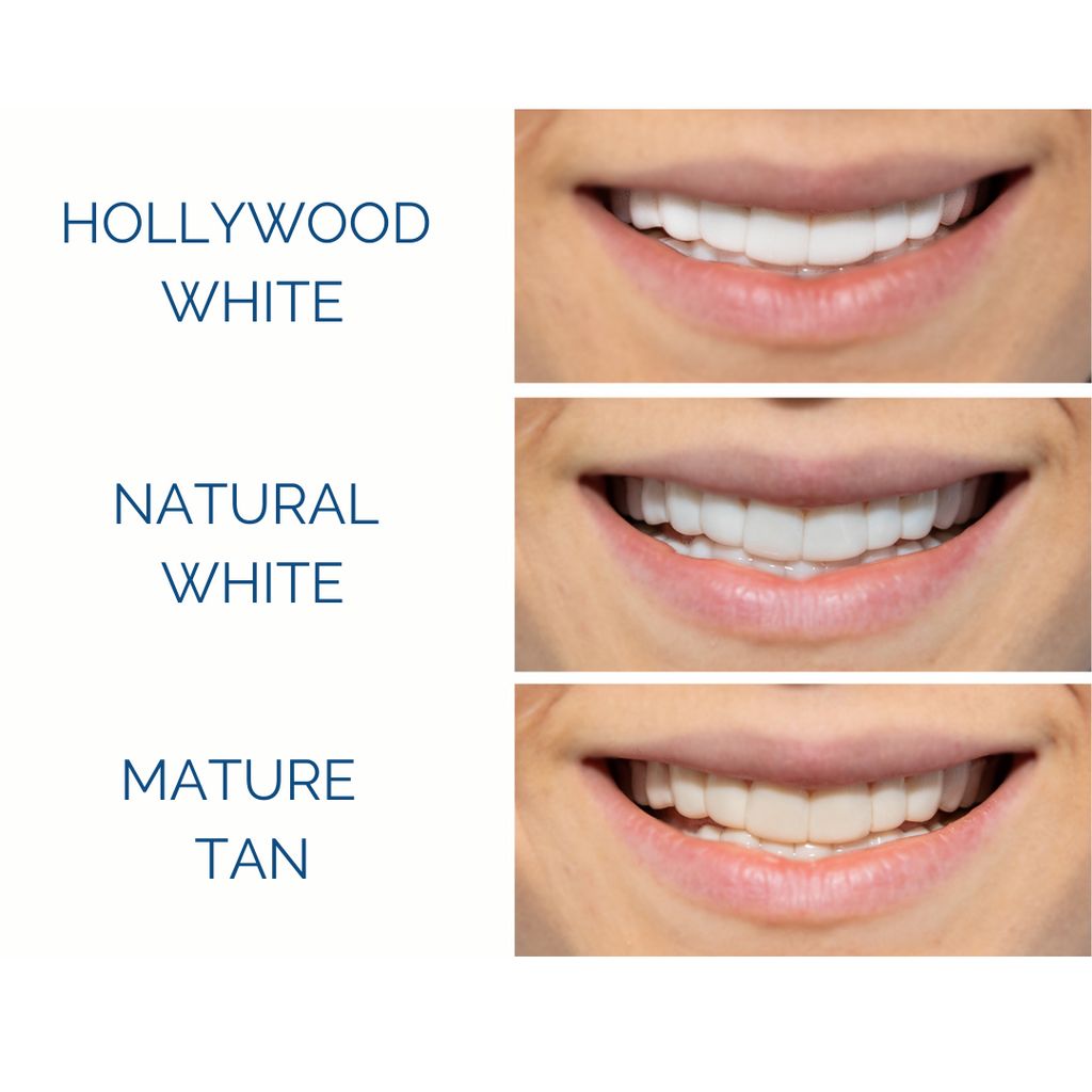Pop-On Veneers
