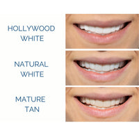 Pop-On Veneers