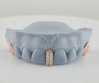 Diamond Strip | Gap Filler Set | 2 Solid Gold DQ1045