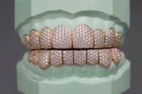 VVs Lab Grown Diamonds Iced Out Grillz - DQ1004