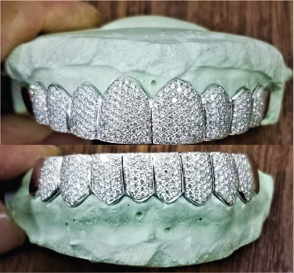 VVS Natural Diamond Honeycomb Set Grillz: Luxury for Your Smile DQ1043