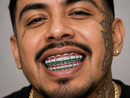 Emerald Cut Moissanite Grillz - DQ8626