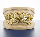 Open Face Diamond Cut Grillz -  DQ1014