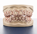 Open Face Diamond Cut Grillz -  DQ1014