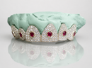 Cosmic Crown Grillz – Ruby Orbit Edition 6 or 12 Set - DQ1010