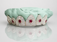 Cosmic Crown Grillz – Ruby Orbit Edition 6 or 12 Set - DQ1010