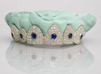 Cosmic Crown Grillz – Ruby Orbit Edition 6 or 12 Set - DQ1010
