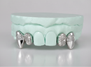 Silver Moissanite 4-Piece Grillz with Extended Fangs DQ1036