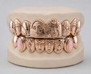 Gold Grillz With Custom Theme Design - DQ1060