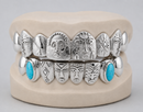Gold Grillz With Custom Theme Design - DQ1060
