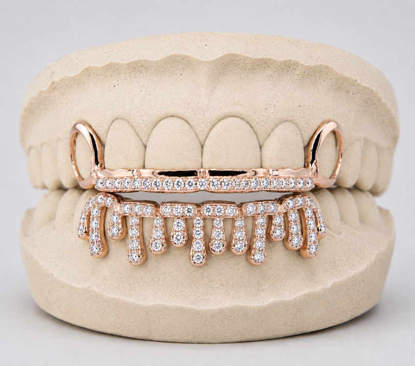 Alexis Edition; Drip & Rail Moissanite Gold Grillz – DQ1059 – Gold